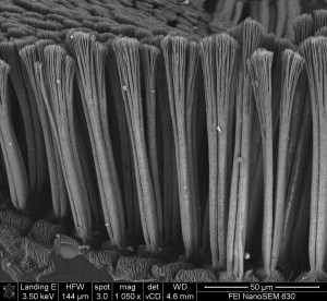 Electron microscope image of setae