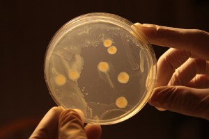 Bacterial colonies spatially compete for food. Photo courtesy of Xtinabot.