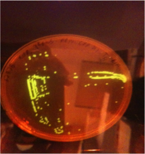Agar plate showing a culture of the human pathogen Acinetobacter baumannii ATCC 17978 with fluorescently tagged plasmid pB10::gfp. We use fluorescence as a proxy to detect the presence of multidrug-resistance plasmids.  Acinetobacter is a remarkable medical concern as it is responsible for an increasingly high number of multi-drug resistant infections worldwide. 