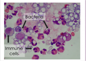 Figure 1: Example of immune and bacterial cells found in “healthy” human milk